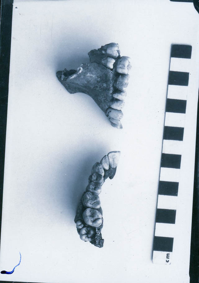 Human dentition
