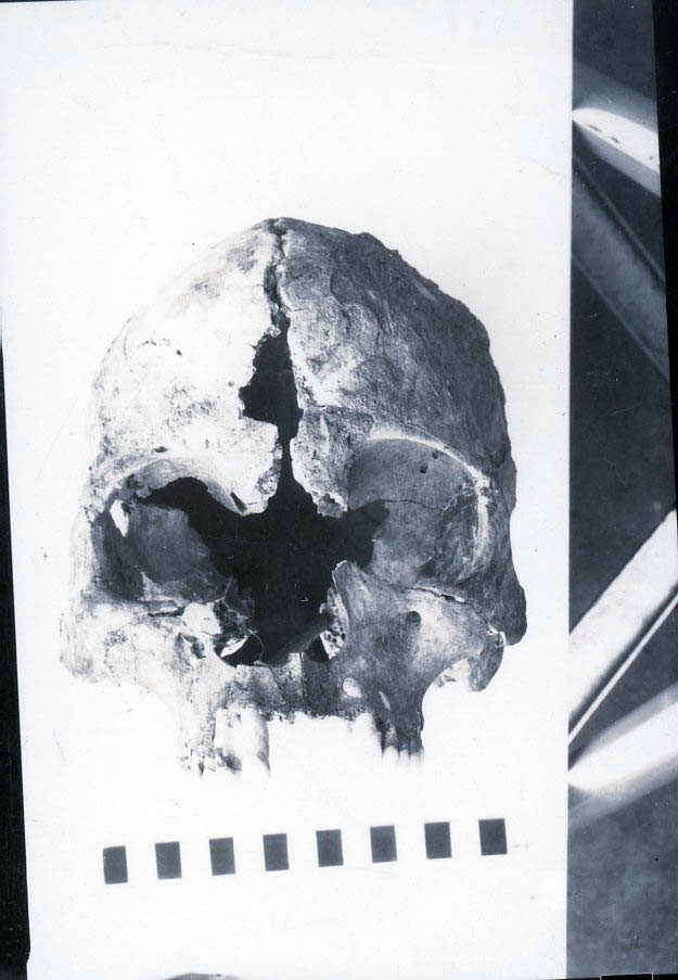 Human Skull