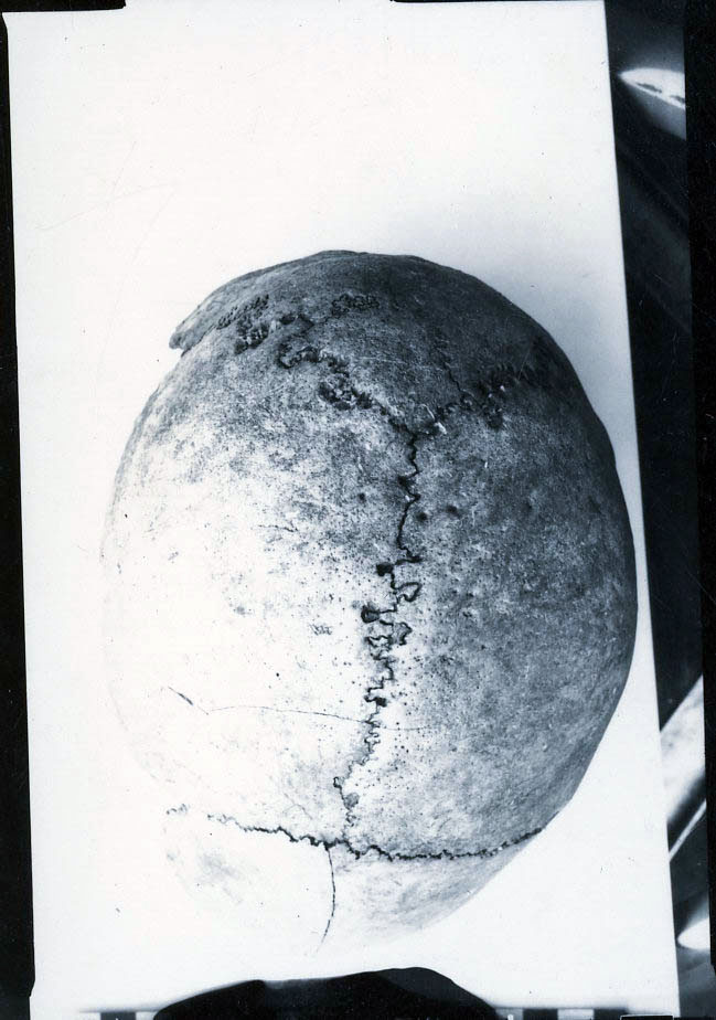 Human Skull